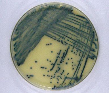 Folia Microbiol MacConkey agar (CT-SMAC; Oxoid) and enterohemolysin agar (Sifin; Labmedia Servis, Czech Republic) for 18 h. The isolated strain was confirmed as E.