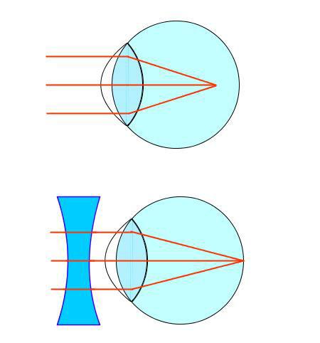 Konvenční zraková vzdálenost: oko se nejvíce unaví při pozorování předm tů v okolí blízkého bodu (nejv tší akomodace) bez v tší únavy lze sledovat předm ty v konvenční zrakové vzdálenosti dohodou