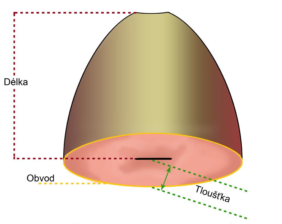Výsledný tvar odebrané tkáně byl ideálně ve tvaru kužele.