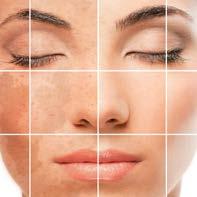 Cx M SLOŽENÍ md:complex TM melanoceuticals Cx M Revitalizující fyziologický roztok KYSELINA TRANEXAMOVÁ: Inhibuje syntézu melaninu, blokuje interakci mezi melanocyty a keratinocyty pomocí inhibice