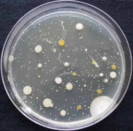 Celkový počet mikroorganismů Celkový počet mikroorganismů (CPM) představuje počet mezofilních aerobních a fakultativně anaerobních mikroorganismů, které rostou na neselektivních, ale