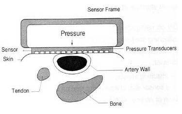 TONOMETR tlaková vzduchová komora senzor kůže tlak měničů stěna artérie šlacha kost Obr. 20 Schematické znázornění měření pomocí piezoelektrického snímače.