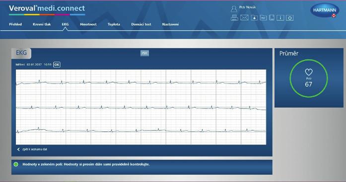 DŮLEŽITÉ UPOZORNĚNÍ. NEŽ BUDETE STAHOVAT DATA DO MEDICONNECTU: 1. Ujistěte se, že máte v přístroji nastavený správný datum a čas. 2.