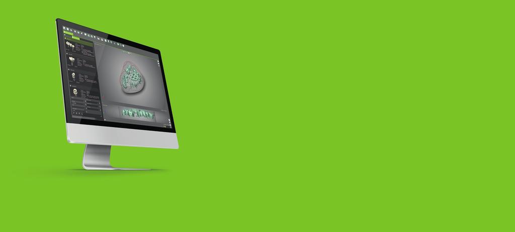 DIGITÁLNÍ MODELACE A VÝBĚR TYPU VÝROBY Každý skener Straumann je dodáván s plně integrovaným softwarem CARES Visual, který Vám umožňuje modelaci širokého spektra protetických rekonstrukcí s následným