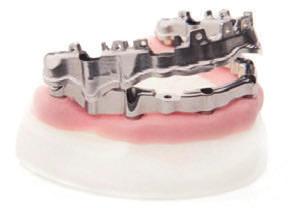 gingivou Individuální tvary Náhrady nesené implantáty Náhrady nesené abutmenty* Materiály Chromkobalt Titan třídy 5 Createch Snímatelné náhrady Třmeny Createch řešení pro bezzubé čelisti