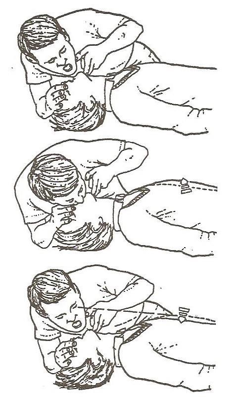PŘÍLOHA D: Grafické znázornění techniky dýchání z úst do úst Obrázek 36: Technika dýchání z úst do úst PACHL Jan a Karel ROUBÍK, Základy