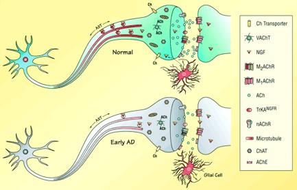 2.3.1 Poškození cholinergních neuronů při Alzheimerově nemoci Rozsáhlá ztráta cholinergní inervace v mozkové kůře bývá považována za typický projev pokročilého stádia Alzheimerovy nemoci.