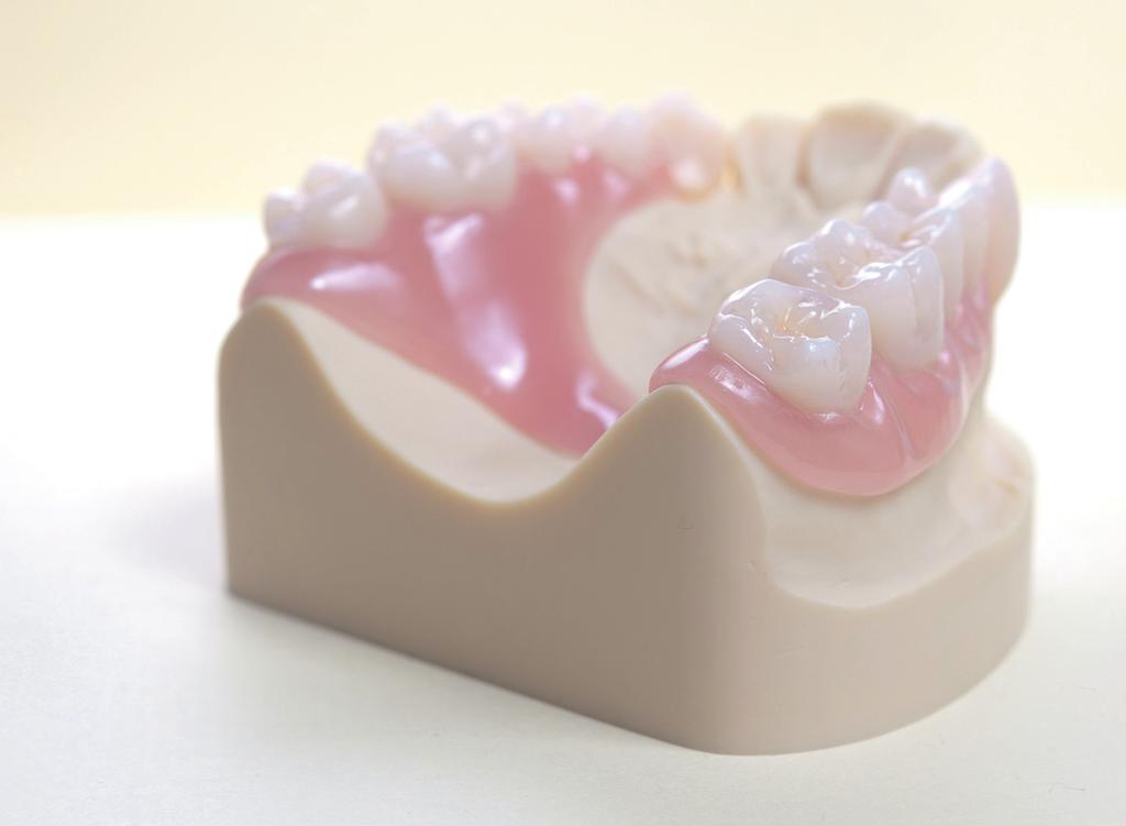 Tento článek se zabývá řadou běžných plastových materiálů, které se staly alternativami pro použití při výrobě nekovových teleskopických zubních náhrad.