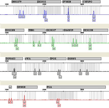 Postup DNA profilování PCR