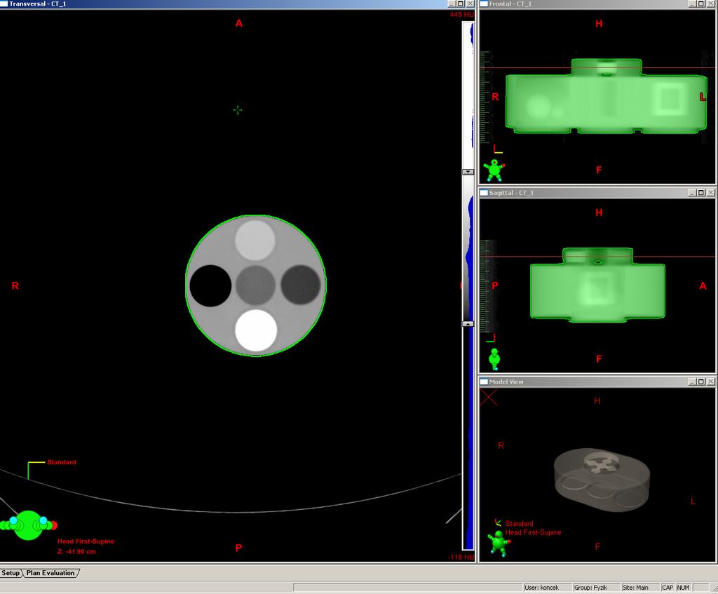 Stanovení CT čísel v CT konzoli 1. V CT konzoli vyberte transverzální CT řez v blízkosti středu části fantomu s válečky pro ověřování RED. 2.