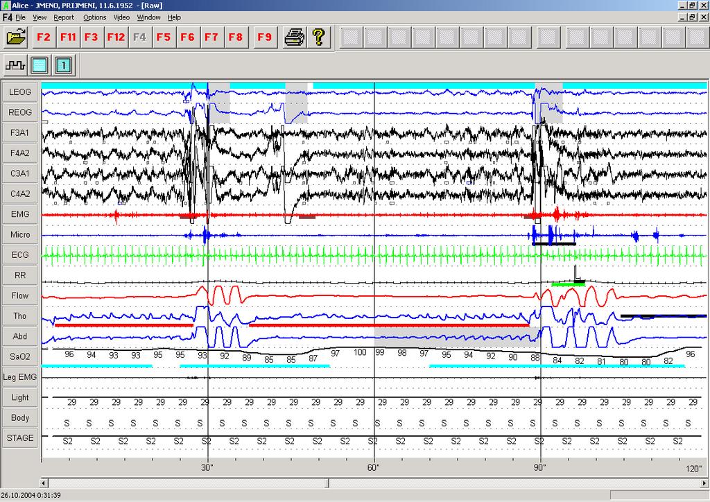 Neurologie v Hradci Králové Electrophysiological Laboratory Charles University in Prague