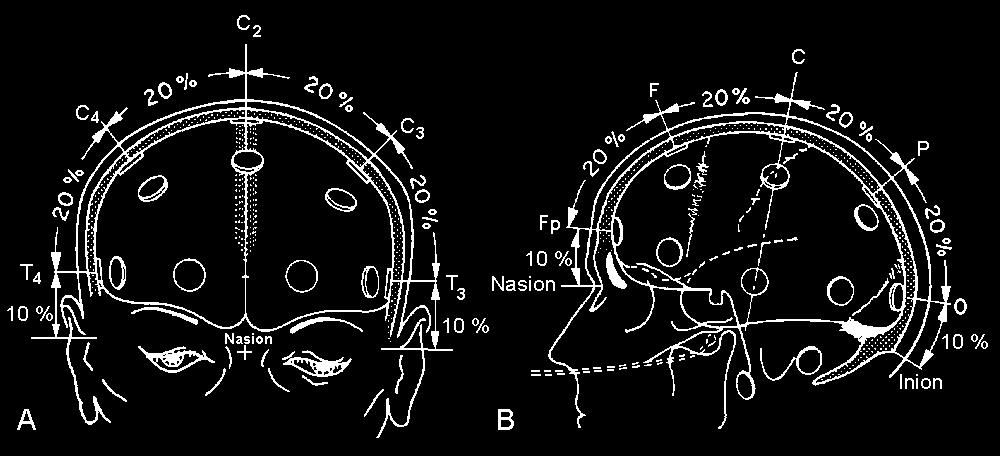 EEG Recording positions The original figure illustrating the