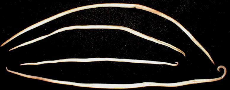 Ascaris lumbricoides: