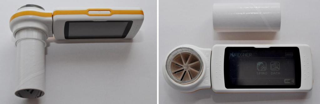Na výsledek spirometrie má vliv mnoho faktorů, je to například věk, etnická skupina, váha, výška a další.