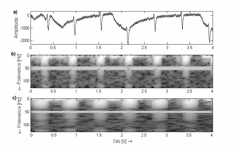5..2.2 Časově-frekvenční analýza, spektrogramy rozdělení sgnálu na segmenty o délce časové rozlšení, frekvenční rozlšení ( ΔΩ 2π/T ) segmenty se mohou