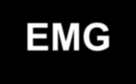 Příklad integrovaného EMG (pásmově omezené) EMG
