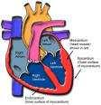Ischemická choroba srdeční (ICHS) Skupina onemocnění, jejichž