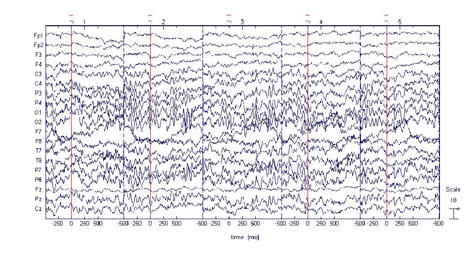 segmentovaná EEG data pro znak