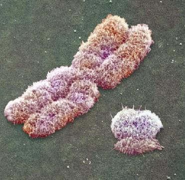 Evoluce pohlavních chromosomů Nothing in biology make