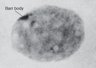 Inaktivace chromosomu X u samic savců Objevena v roce 1961 Mary Lyon.