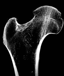Funkční stavba kosti Wolfovo pravidlo kost je remodelována podle mechanického zatížení, které na ni působí Pravidlo