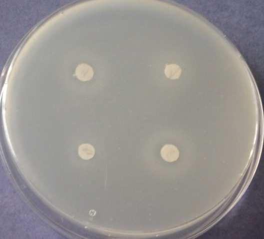 pokr. 3) IMIDAZOLIDINYLUREA -
