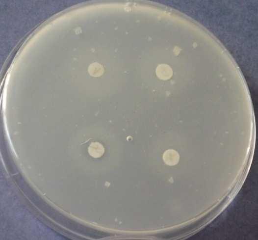 7: Imidazolidinylurea 3.