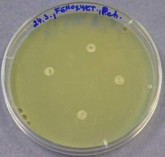 den - Bacillus subtilis 8) FENOXYETHANOL - Penicillium