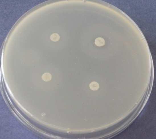 den - Bacillus 32: Methylisothiazolinon