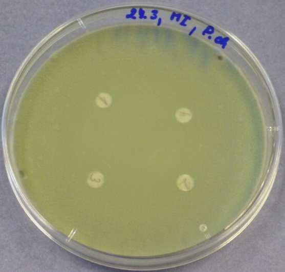 den - Bacillus subtilis 12) METHYLISOTHIAZOLINON - Penicillium