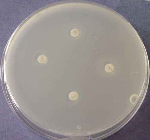 OLEJ - Bacillus subtilis Obr. 9.4.