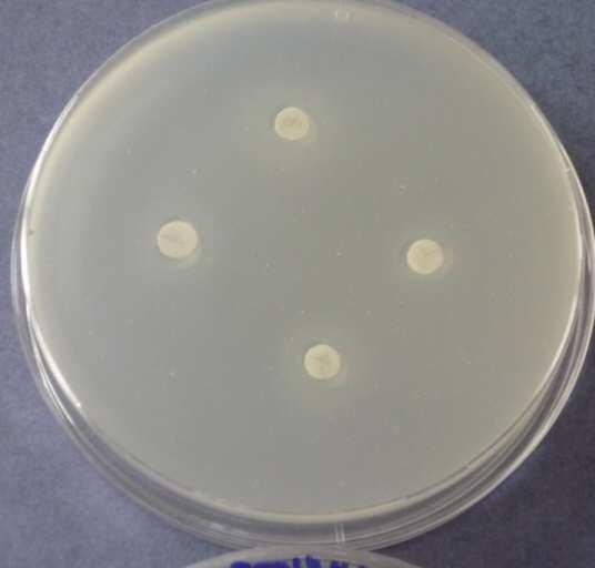 5) FENYKL - Bacillus subtilis Obr.