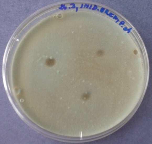 4: Imidazolidinylurea 10.