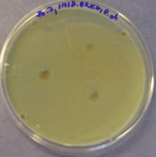 5: Imidazolidinylurea 3.