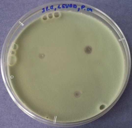 Penicillium chrysogenum - ředění 0,7 %; 1%; 10 %; 25 %;