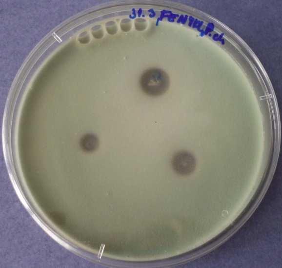aplikované na Penicillium chrysogenum -