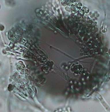 Alternaria 2) 3)