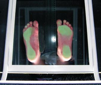 18 Podiatrie Základní podiatrické vyšetření Vyšetření na plantoskopické desce Miroslav Havrda 1. viceprezident České podiatrické společnosti Obr.