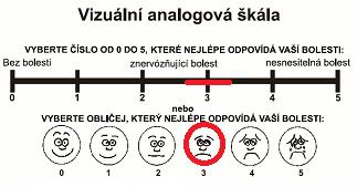 6.1.2 Dotazník Pacientka měla za úkol zakreslit typickou bolest hlavy.