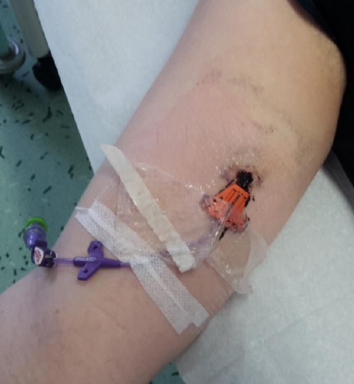 Komplikace a jak je řešíme.