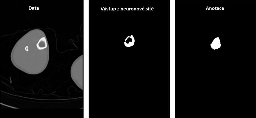 Zleva: vstup do neuronové sítě, výstup z neuronové sítě a anotace.