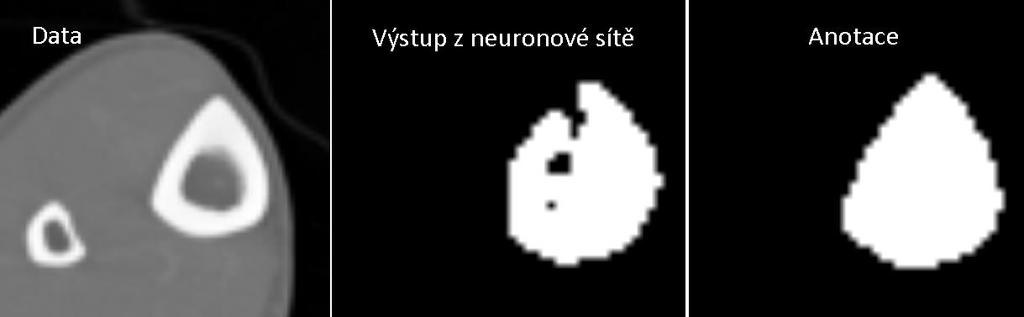 Dosažená přesnot 95,1%.