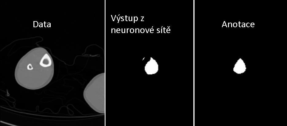 Zleva: vstupní data, výstup z neuronové sítě a anotace.