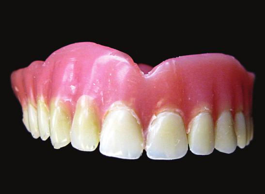 Obr. 3 Obr. 4 Obr. 3: Stará zubní náhrada z klasické pryskyřice Obr.