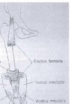 articularis genus, které se upínají do přední plochy pouzdra v oblasti recessus suprapatellaris. M.