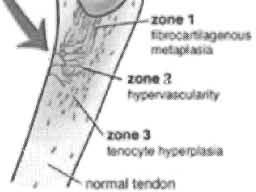 Známky akutního zánětu prokázány nebyly (Lian et al, 00; Novotný et al.,00).