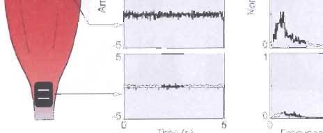 trapezius pars descendens. Musí se vybrat takové místo, kde nedoje při pohybu k vypojení elektrody vlivem ohybu kůže (Konrad, 00).