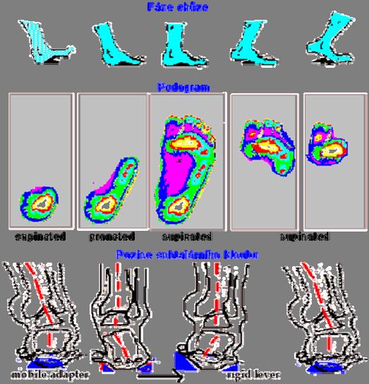 Když se analyzují obrazy získané při chůzi na podoskopu, lze konstatovat, že statický tlakový obraz je složen z mozaiky dynamických tlakových obrazů, které vznikají v jednotlivých fázích chůze.