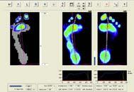 získání datových počítačových hodnot při chůzi na speciálních chodnících snímajících tlakové hodnoty nohy, prostřednictvím piezoelektrických krystalů.