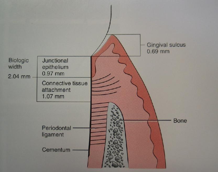 Spojovací epitel Gingiva libera Gingiva affixa připojení epitelem 1 2 mm připojení vazivem 1 9 mm